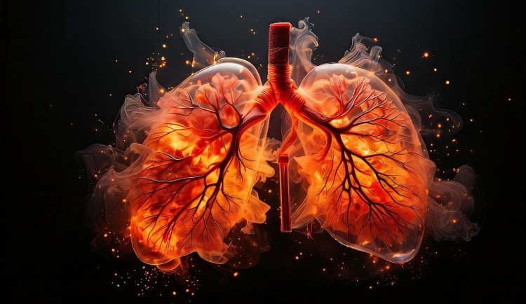 CHOPN a spánková apnoe: smrtící dvojka, kterou lze zkrotit léčbou