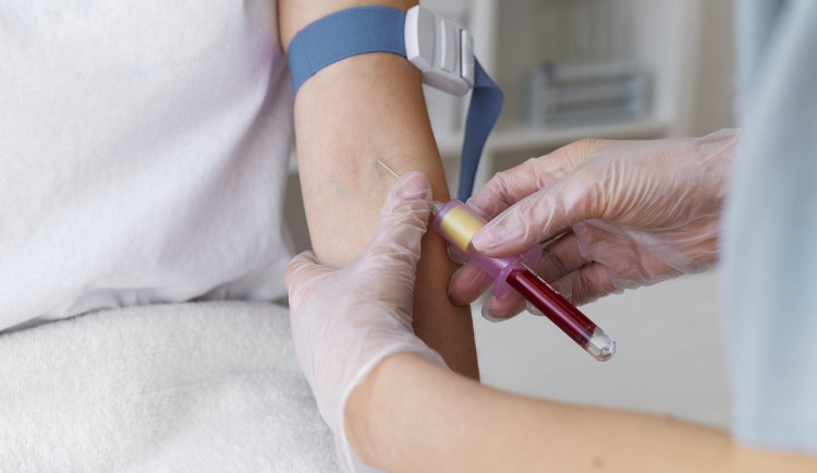 Proč některé laboratorní testy nemají referenční meze?