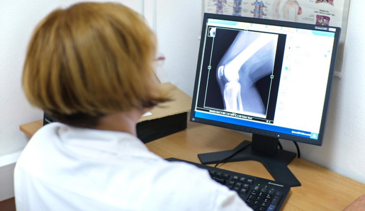 V Nemocnici Šternberk přes léto evidují dvojnásobně více úrazů