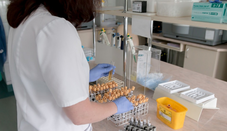 Druhá žena z Bulovky, která měla podezření na koronavirus, má testy negativní