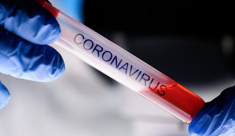 Všeobecná fakultní nemocnice hodlá přijmout tři pacienty z Francie s novým koronavirem