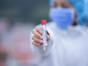 Podle laboratoří v Praze je stanovená cena za test na koronavirus nepřiměřeně nízká
