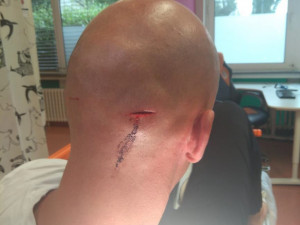 FOTO: Skupinka lidí kradla zboží v Dejvicích. Když je kolemjdoucí muž napomenul, zbili ho