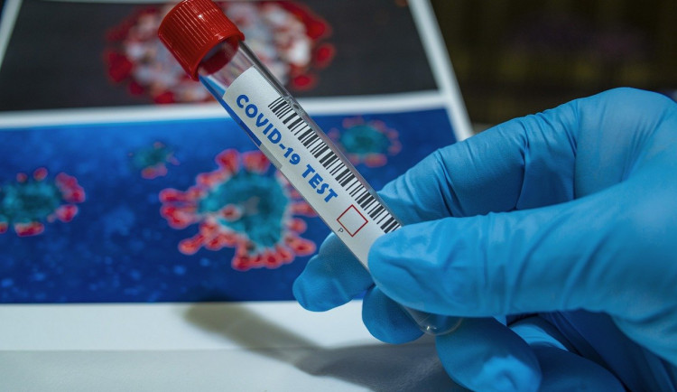 V okrese Karlovy Vary byl po dlouhé době pozitivní test na COVID-19