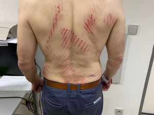 Útočník napadl v metru muže s dětmi, hrozí mu až tři roky ve vězení. Policie hledá svědky