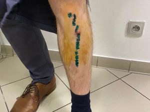 Útočník napadl v metru muže s dětmi, hrozí mu až tři roky ve vězení. Policie hledá svědky