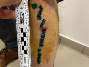 Útočník napadl v metru muže s dětmi, hrozí mu až tři roky ve vězení. Policie hledá svědky