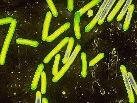 Tetanus pod mikroskopem