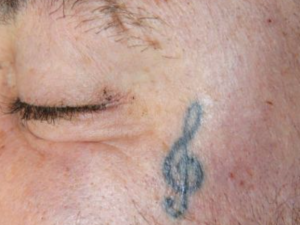 V pražské nemocnici zemřel neznámý muž. Na obličeji měl vytetovaný houslový klíč