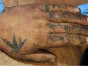 V pražské nemocnici zemřel neznámý muž. Na obličeji měl vytetovaný houslový klíč