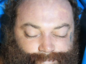 V pražské nemocnici zemřel neznámý muž. Na obličeji měl vytetovaný houslový klíč