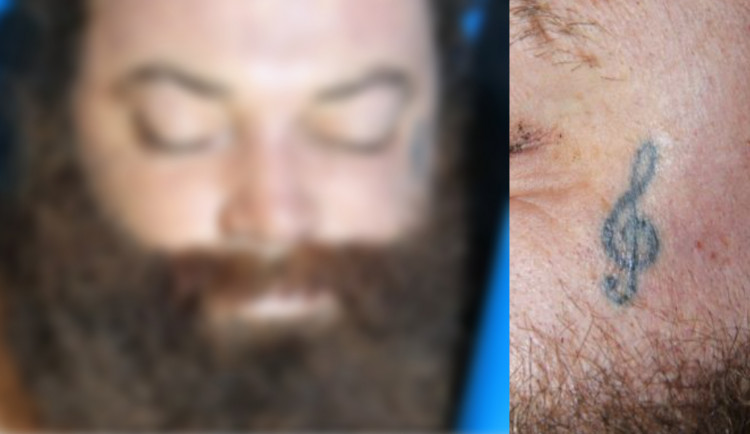 V pražské nemocnici zemřel neznámý muž. Na obličeji měl vytetovaný houslový klíč