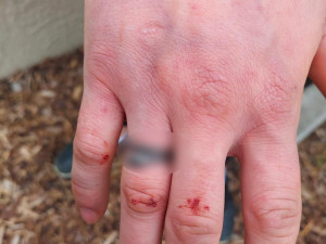 Trojice okradla v parku muže. Útočníci měli v kapsách boxera a čokolády