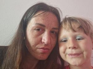 Patka pětileté dcery trpí nemocí, kterou v Česku neumíme léčit. Nyní shání peníze na cestu do Švýcarska