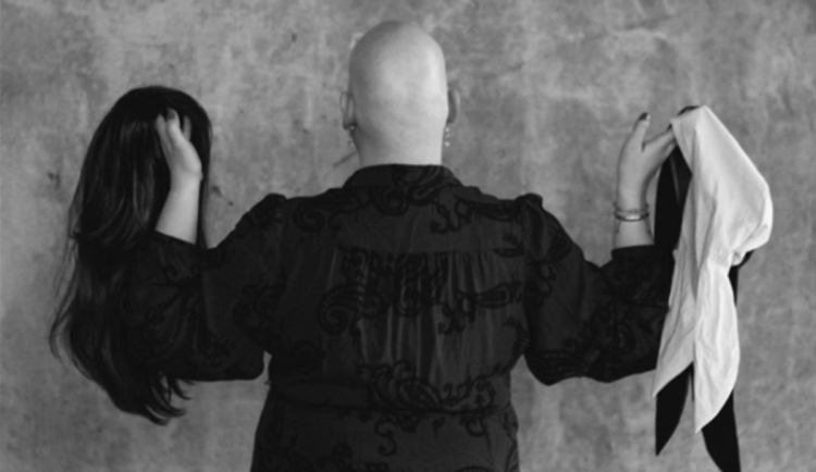 V Liberci se v sobotu setkají lidé s alopecií. Název akce ilustruje jejich postoj, zní Nikdy to nevzdávej