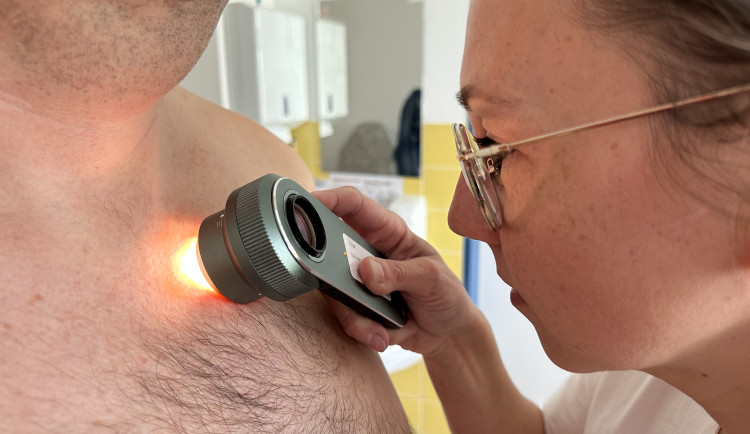 V třebíčské nemocnici kontrolovali kožní znaménka, odhalili zhoubné nádory