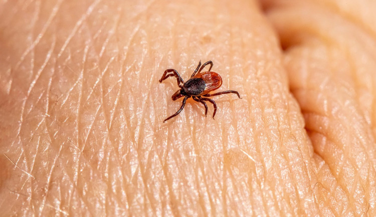 Rekordní počet případů boreliózy. Hygienici hlásí přes 900 nakažených