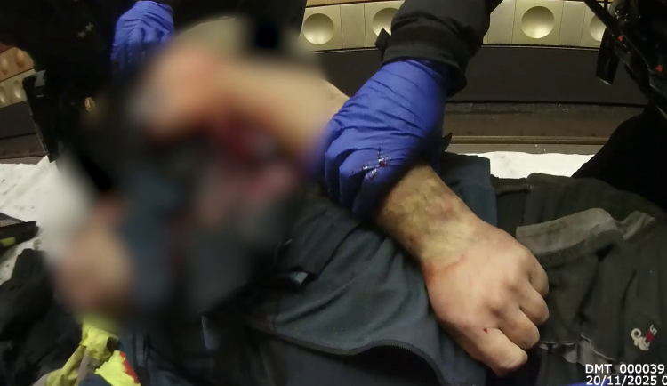 Muž si vážně zranil ruku.