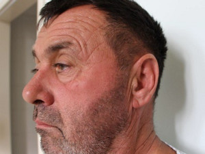 Neznáte ho? Tajemný pacient bohnické nemocnice nemluví, našli ho u popelnic