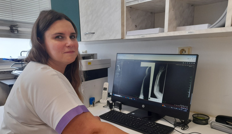 Jak se připravit na jarní prázdniny na horách? Lékaři v Jeseníku už ošetřili stovky úrazů