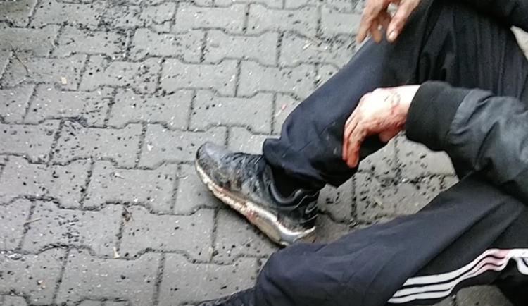 Muž se pořezal na rukou a na hlavě.