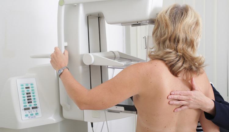 Od poloviny roku na mamograf bez žádanky. VZP klientkám zjednoduší přístup ke screeningu