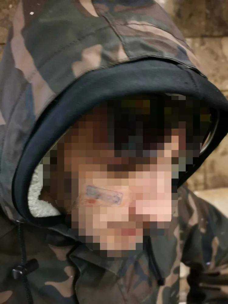 Italové s orazítkovanými obličeji razítkovali vagón metra. Skončili v rukou policie