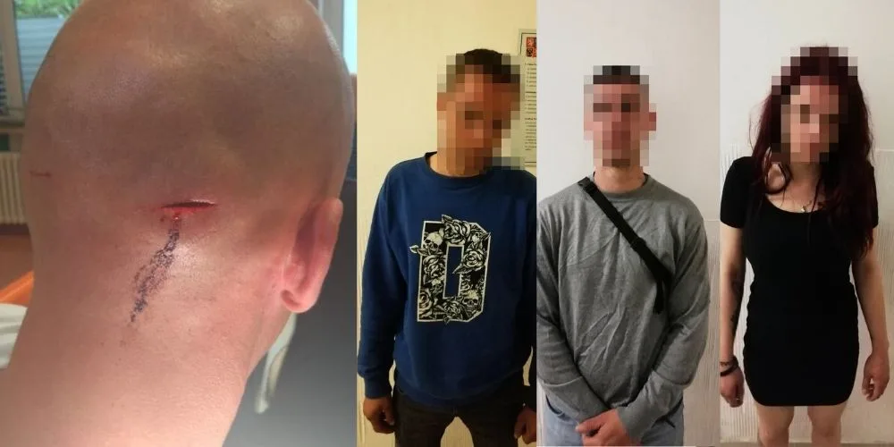 FOTO: Skupinka lidí kradla zboží v Dejvicích. Když je kolemjdoucí muž napomenul, zbili ho
