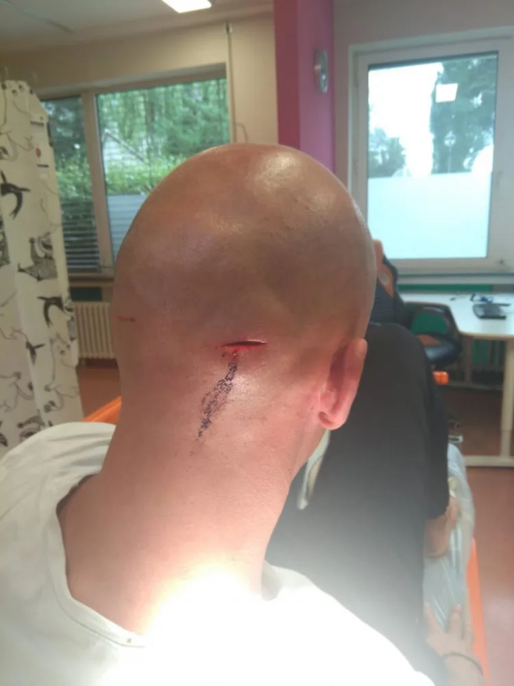 FOTO: Skupinka lidí kradla zboží v Dejvicích. Když je kolemjdoucí muž napomenul, zbili ho