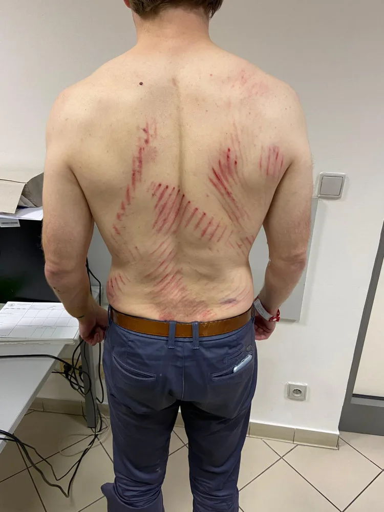 Útočník napadl v metru muže s dětmi, hrozí mu až tři roky ve vězení. Policie hledá svědky