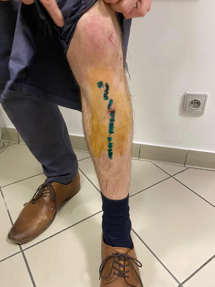 Útočník napadl v metru muže s dětmi, hrozí mu až tři roky ve vězení. Policie hledá svědky