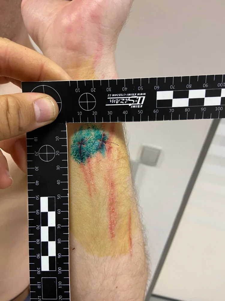 Útočník napadl v metru muže s dětmi, hrozí mu až tři roky ve vězení. Policie hledá svědky
