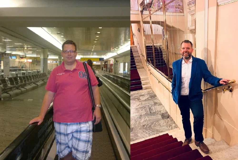 Z XXXL na velikost L? Ondřejovi pomohla plikace žaludku