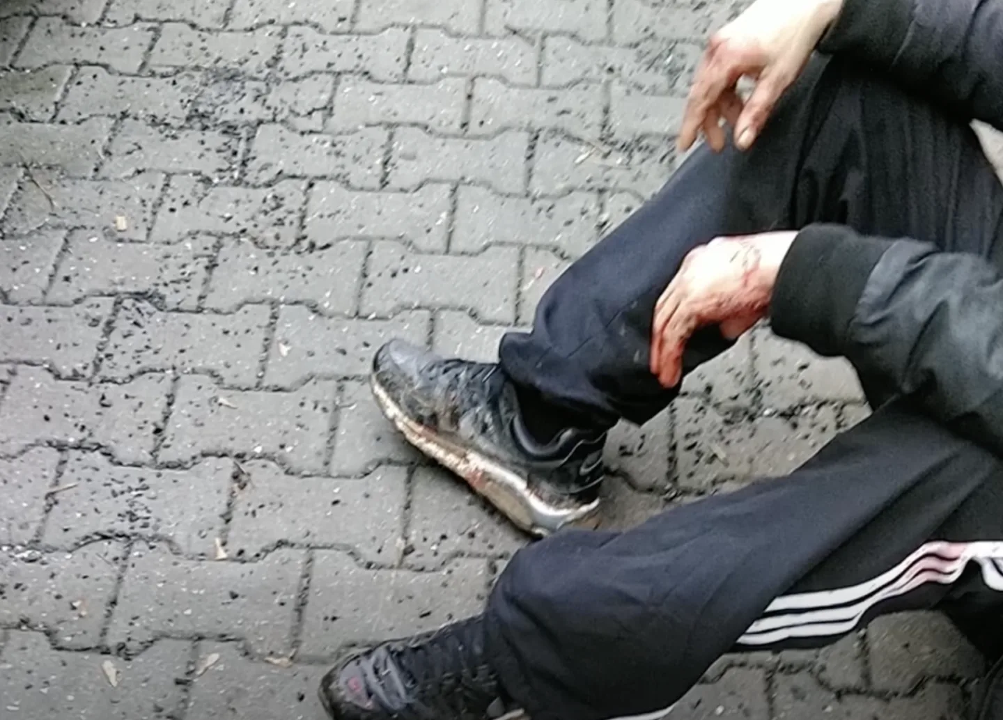 Muž se pořezal na rukou a na hlavě.