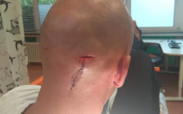 FOTO: Skupinka lidí kradla zboží v Dejvicích. Když je kolemjdoucí muž napomenul, zbili ho