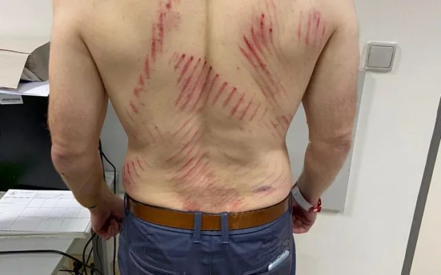Útočník napadl v metru muže s dětmi, hrozí mu až tři roky ve vězení. Policie hledá svědky