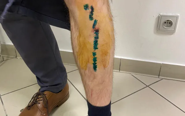 Útočník napadl v metru muže s dětmi, hrozí mu až tři roky ve vězení. Policie hledá svědky