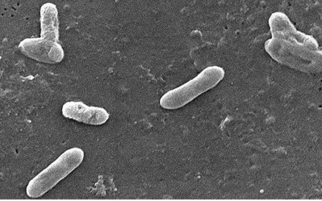 Bakterie Bordetella bronchiseptica jako původce psinkového kašle