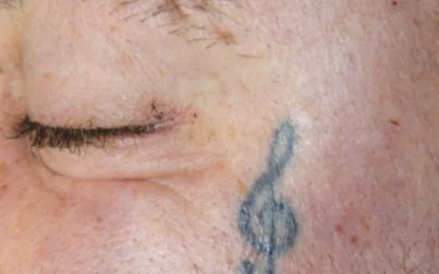 V pražské nemocnici zemřel neznámý muž. Na obličeji měl vytetovaný houslový klíč