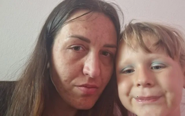 Patka pětileté dcery trpí nemocí, kterou v Česku neumíme léčit. Nyní shání peníze na cestu do Švýcarska
