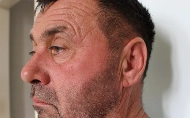 Neznáte ho? Tajemný pacient bohnické nemocnice nemluví, našli ho u popelnic