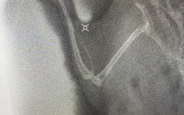 Žádný pacient není příliš malý. Veterináři pražského útulku operovali i křečíka