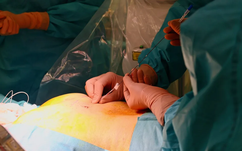 Na Bulovce léčí inkontinenci přelomovou metodou, pomůže chytré zařízení pod kůží